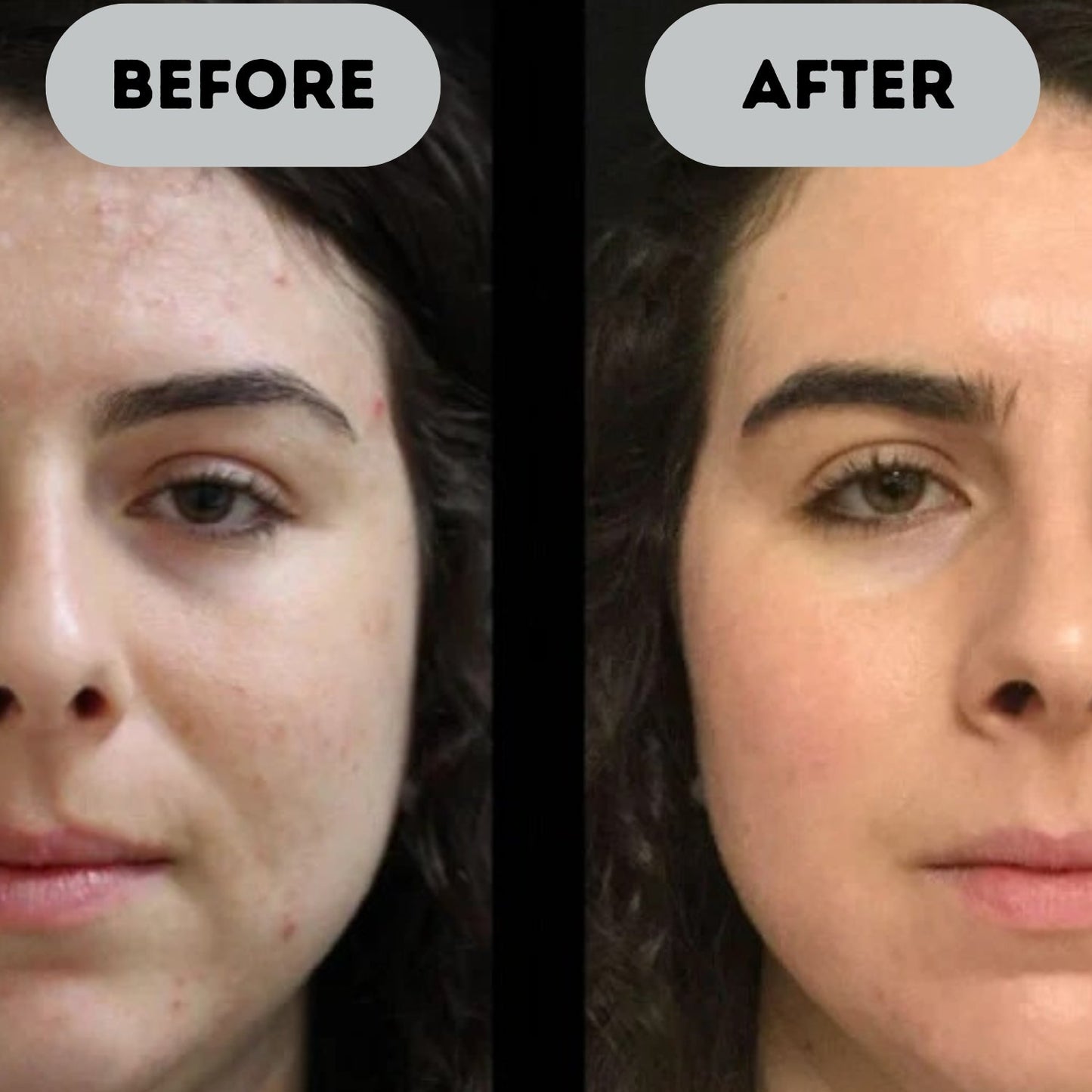 Verida™ - Anti-Aging Booster Pro